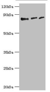 Polyclonal Rabbit anti-Human EZH1 / ENX-2 Antibody (aa160-280, IHC, WB)