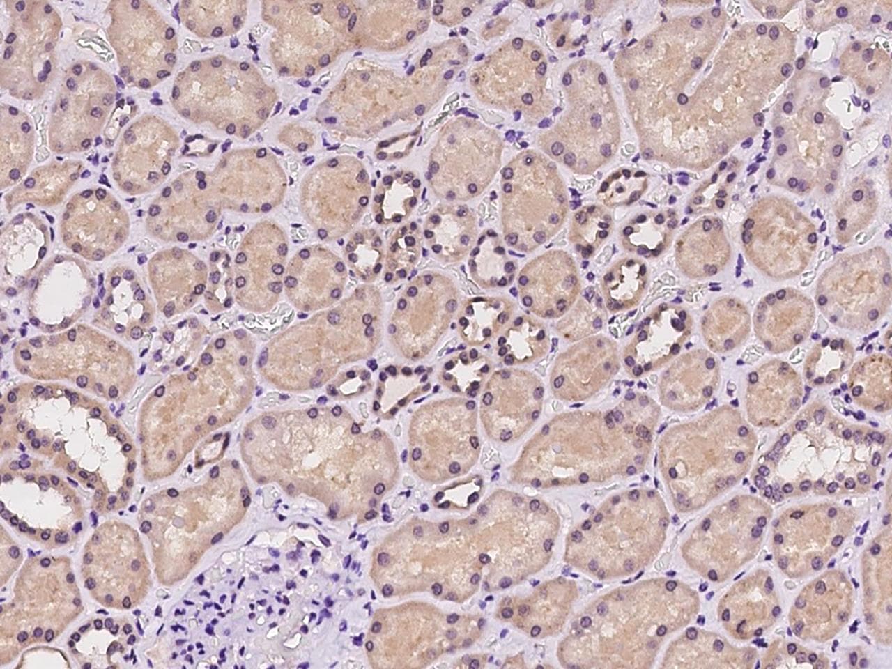 TYK2 Antibody