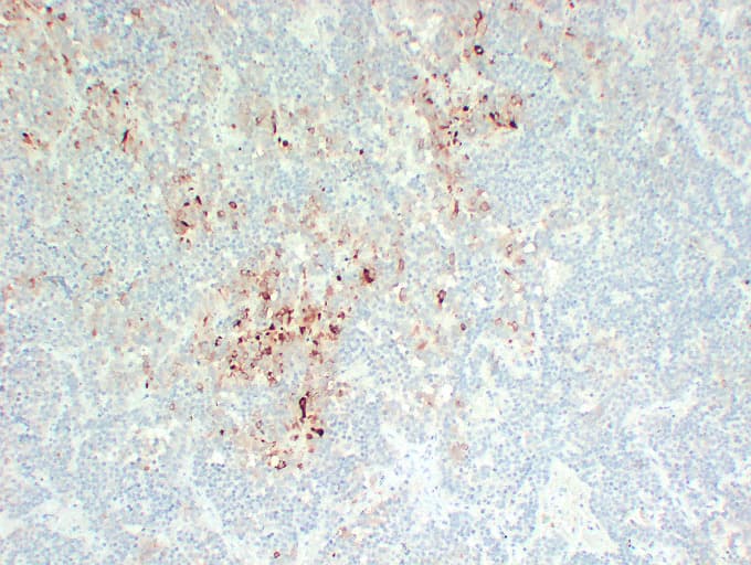 FSHB / FSH Beta Antibody (clone ABT-FSH)