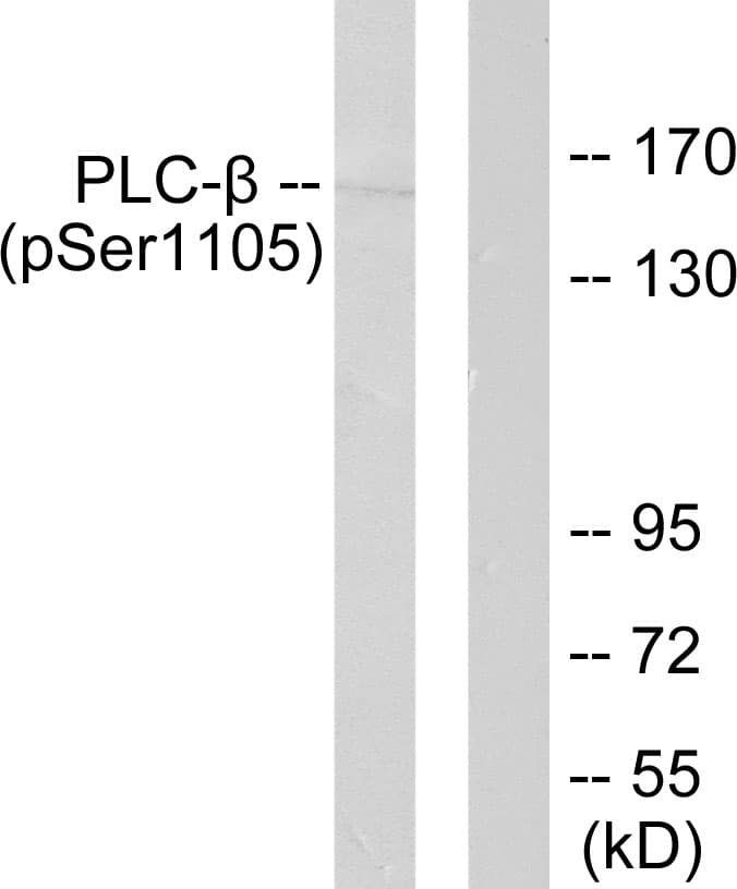 Polyclonal Rabbit anti-Human PLCB3 Antibody (phospho-Ser1105, IHC, WB)