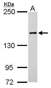 Rho Kinase / ROCK1 Antibody (aa107-371)