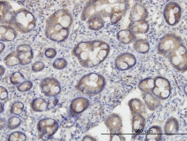 Monoclonal Mouse anti-Human OXSR1 / OSR1 Antibody (clone 1B9, IHC, IF, WB)