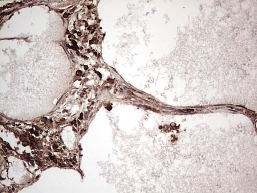 PKM2 Antibody (clone OTI12D5, Carrier-free)