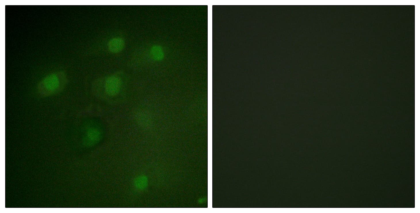 PDCD4 Antibody (aa420-469)