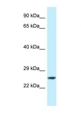 EIF3K Antibody (C-Terminus)