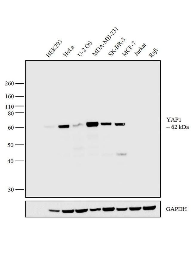 Monoclonal Mouse anti-Human YAP / YAP1 Antibody (clone 1A12, IHC, WB)