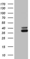 Monoclonal Mouse anti-Human OTC Antibody (clone OTI3B9, aa33-354, WB)