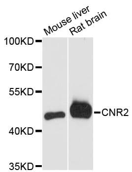 CNR2 / CB2 Antibody