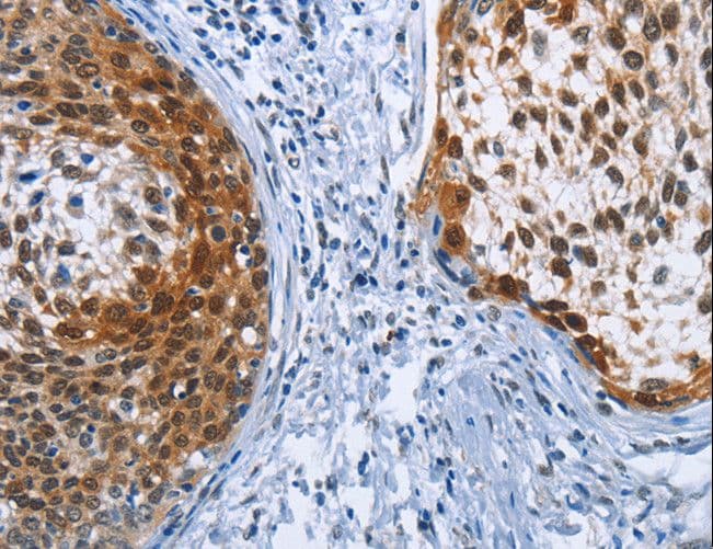 Polyclonal Rabbit anti-Human CRABP2 Antibody (IHC)