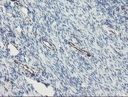 Monoclonal Mouse anti-Human PECAM-1 / CD31 Antibody (clone OTI1C2, IHC, WB)