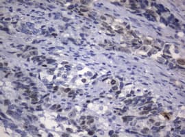 Monoclonal Rat anti-Human MKI67 / Ki67 Antibody (clone OTI9C3, IHC, WB)