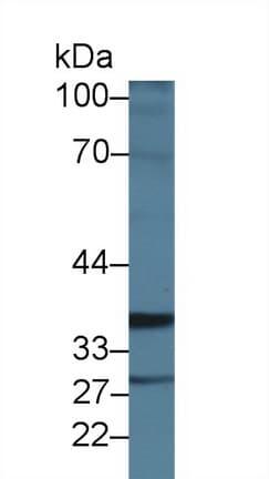 ICK Antibody (aa1-284, APC)