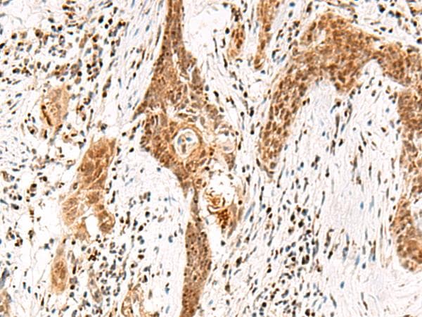 Polyclonal Rabbit anti-Human DGCR6L Antibody (IHC, WB)