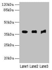 Polyclonal Rabbit anti-Human C5orf45 Antibody