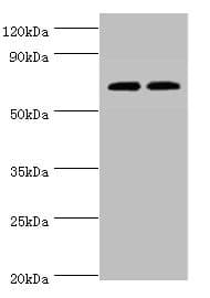 Polyclonal Rabbit anti-Human APBB1IP / RIAM Antibody (aa1-150, IHC, WB)