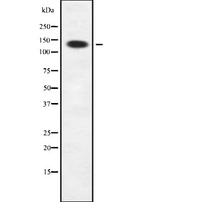 Polyclonal Rabbit anti-Human SIN3B Antibody (IHC, IF, WB)