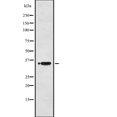 BRCC3 / BRCC36 Antibody