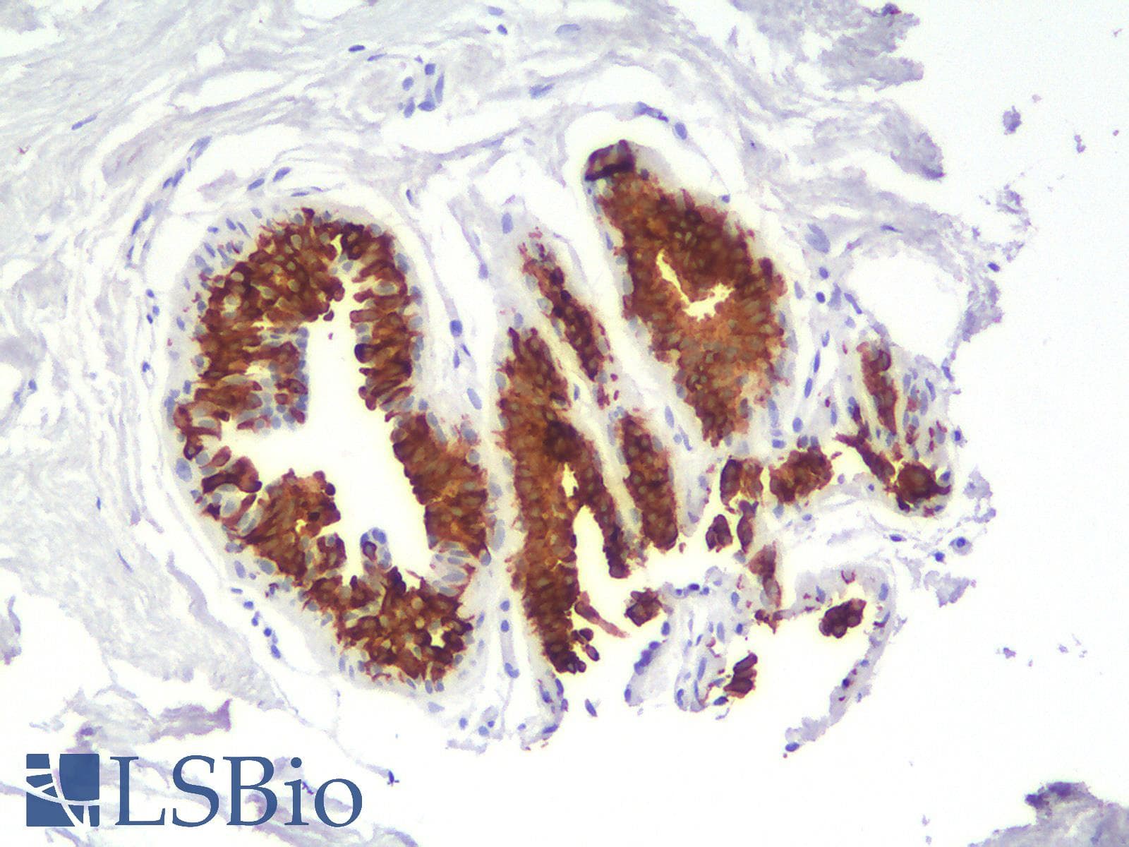 PathPlus™ KRT19 / CK19 / Cytokeratin 19 Antibody (clone rKRT19/799)