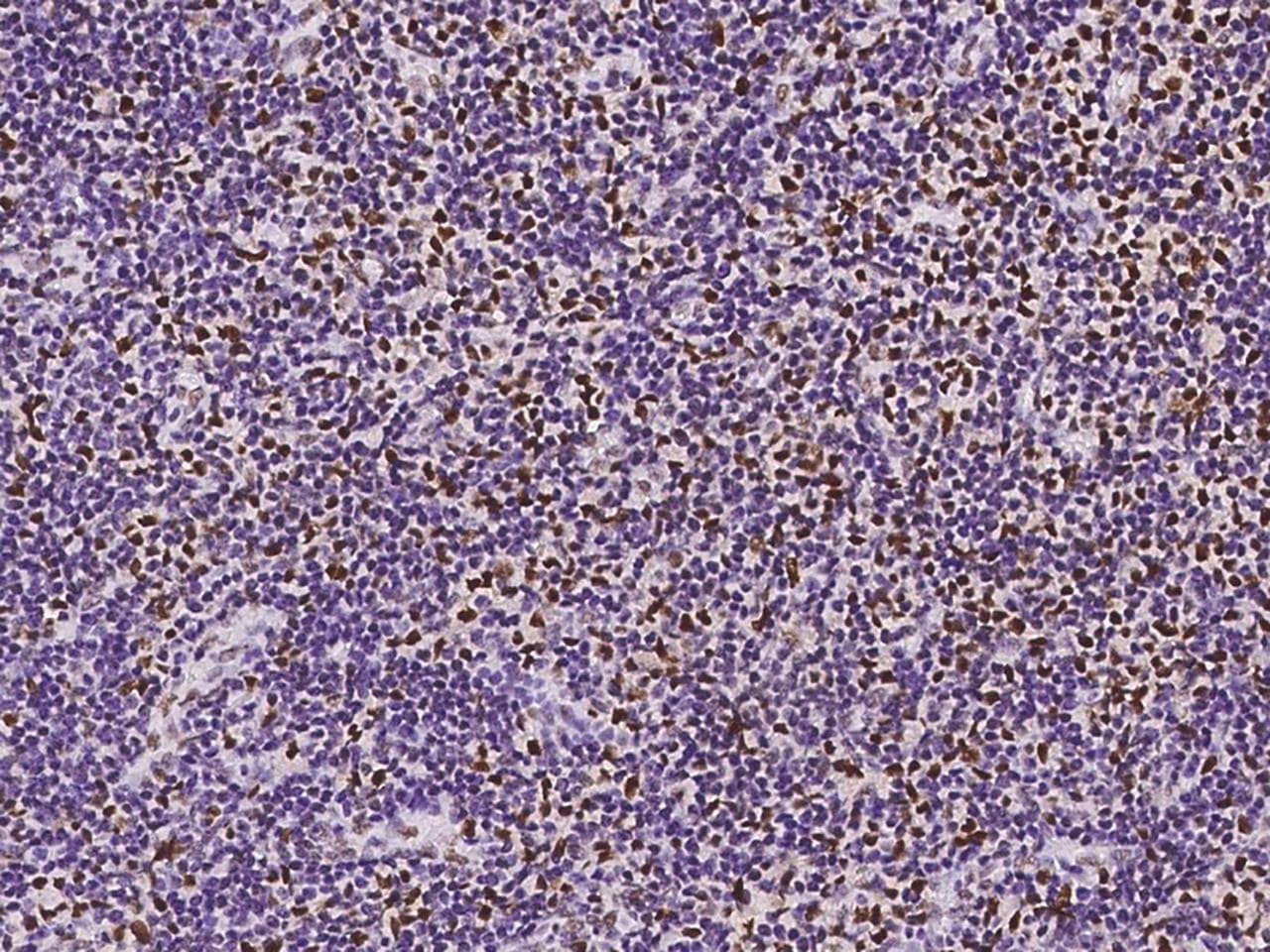 BTBD9 Antibody