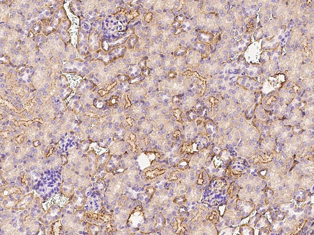 CLEC3B / Tetranectin Antibody (Preservative Free)