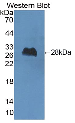 PathPlus™ CHAT Antibody (aa517-732)