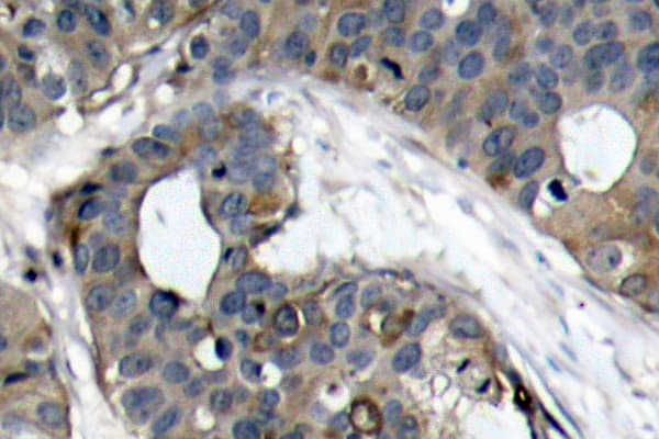 HSPB1 / HSP27 Antibody (Arg75)