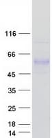 Human IL6R / IL6 Receptor Protein (Recombinant Myc-DDK (Flag))