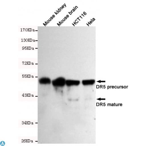 TNFRSF10B / Killer / DR5 Antibody