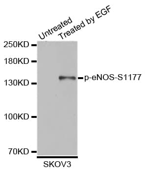 NOS3 / eNOS Antibody (phospho-Ser1177)