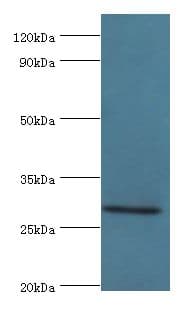 Polyclonal Rabbit anti-Human COLEC11 Antibody (aa26-271, IHC, WB)