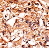 GSK3B / GSK3 Beta Antibody (phospho-Ser21/Ser29)