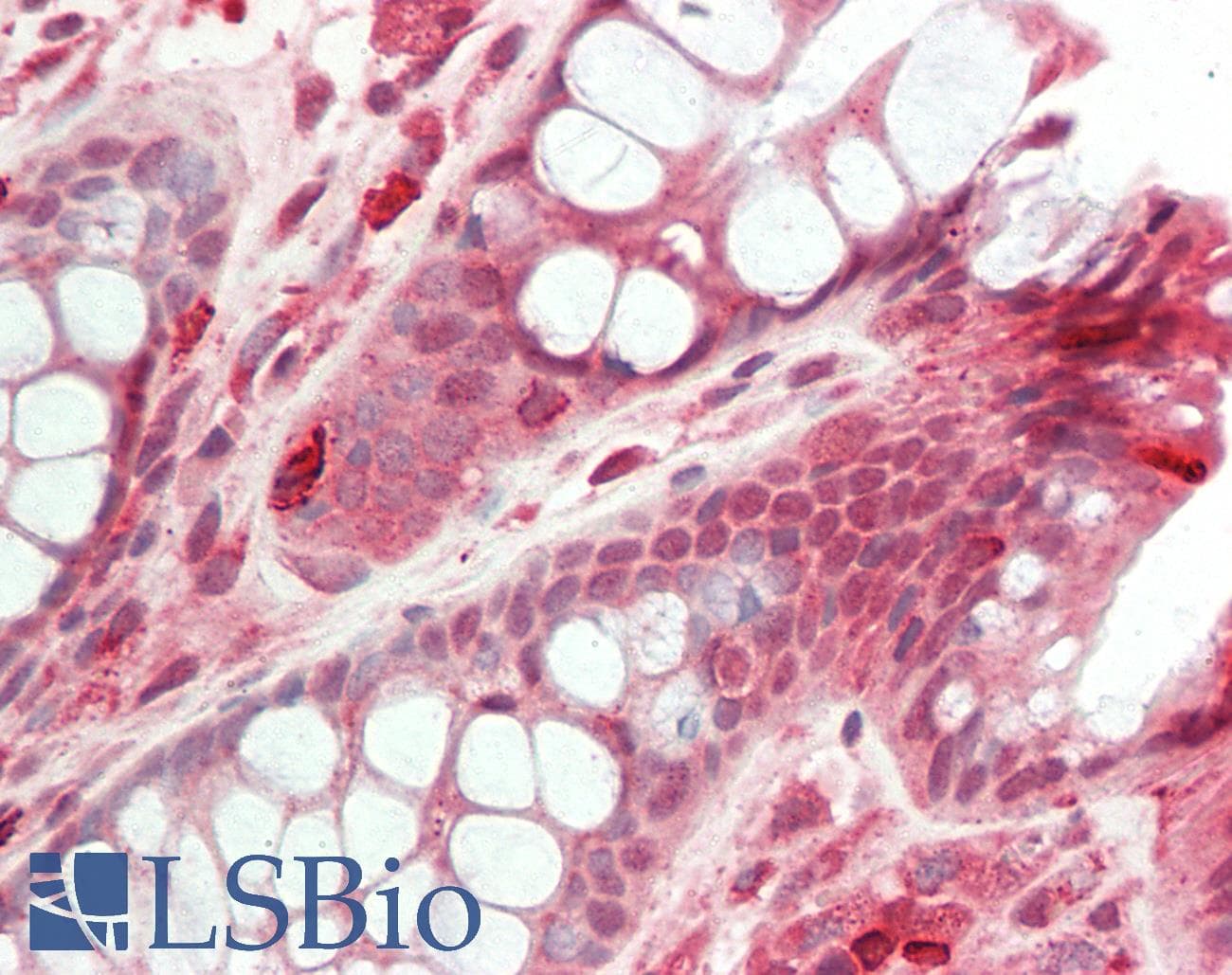 IHC-plus™ HDAC5 Antibody (aa200-250)