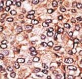 Polyclonal Rabbit anti-Human MAGEA2 Antibody (aa81-108, IHC, WB)