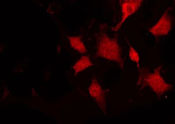 AURKA / Aurora-A Antibody