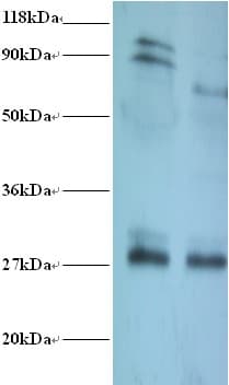 TPMT Antibody (HRP)