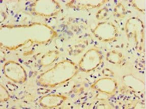 CDH11 / Cadherin 11 Antibody (aa637-796)