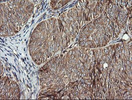 ACAA2 Antibody (clone OTI1D3)