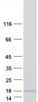 Human PTHLH / PTHRP Protein (Recombinant Myc-DDK (Flag))