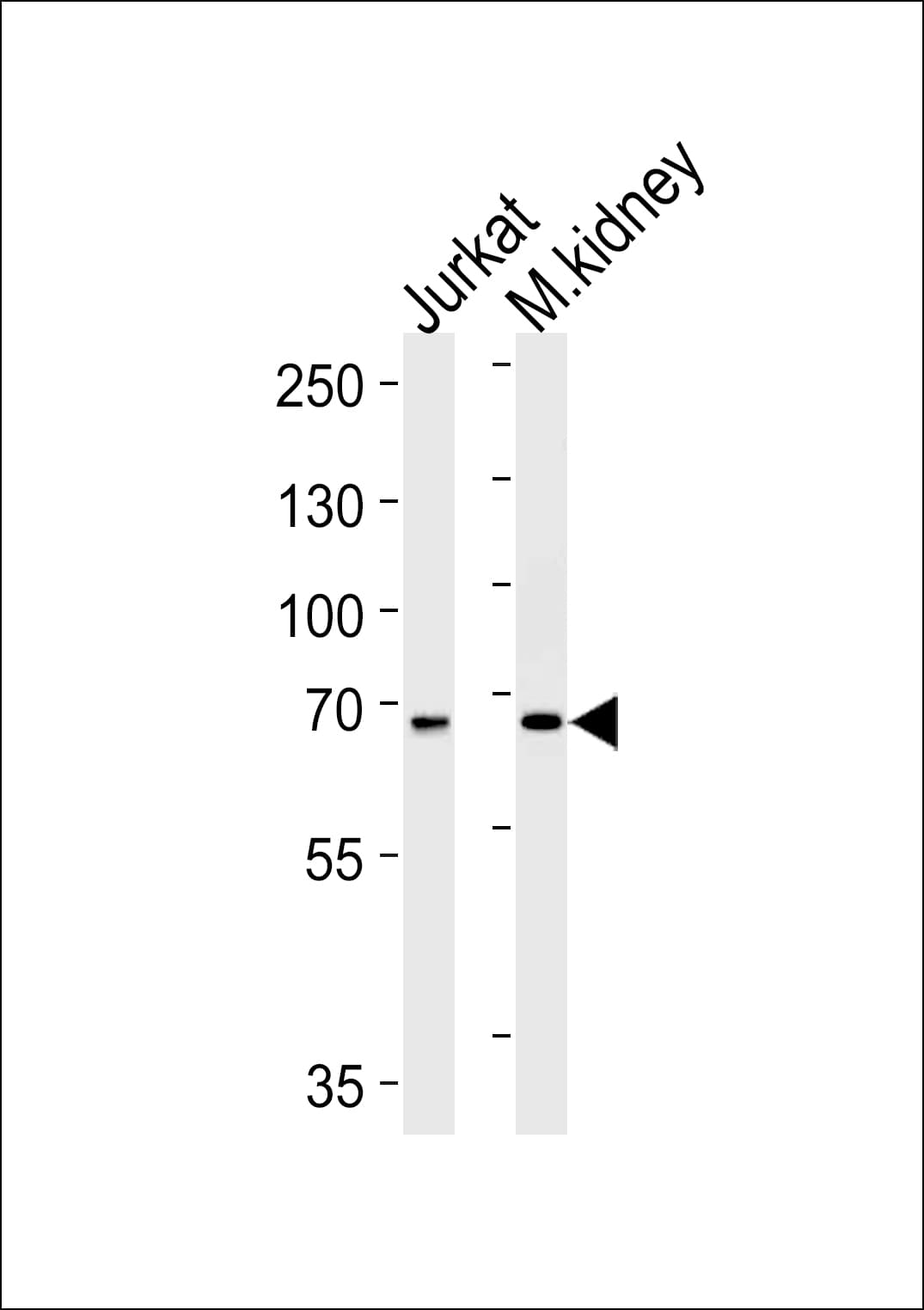 Polyclonal Rabbit anti-Human TCF12 / HEB Antibody (aa55-84, WB)