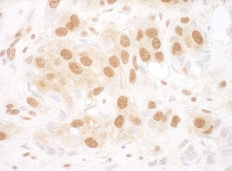 TIP48 / RUVBL2 Antibody (aa1-50)