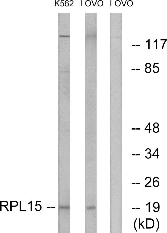Polyclonal Rabbit anti-Human RPL15 / Ribosomal Protein L15 Antibody (WB)