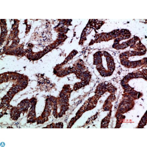 GREM2 / Gremlin 2 Antibody