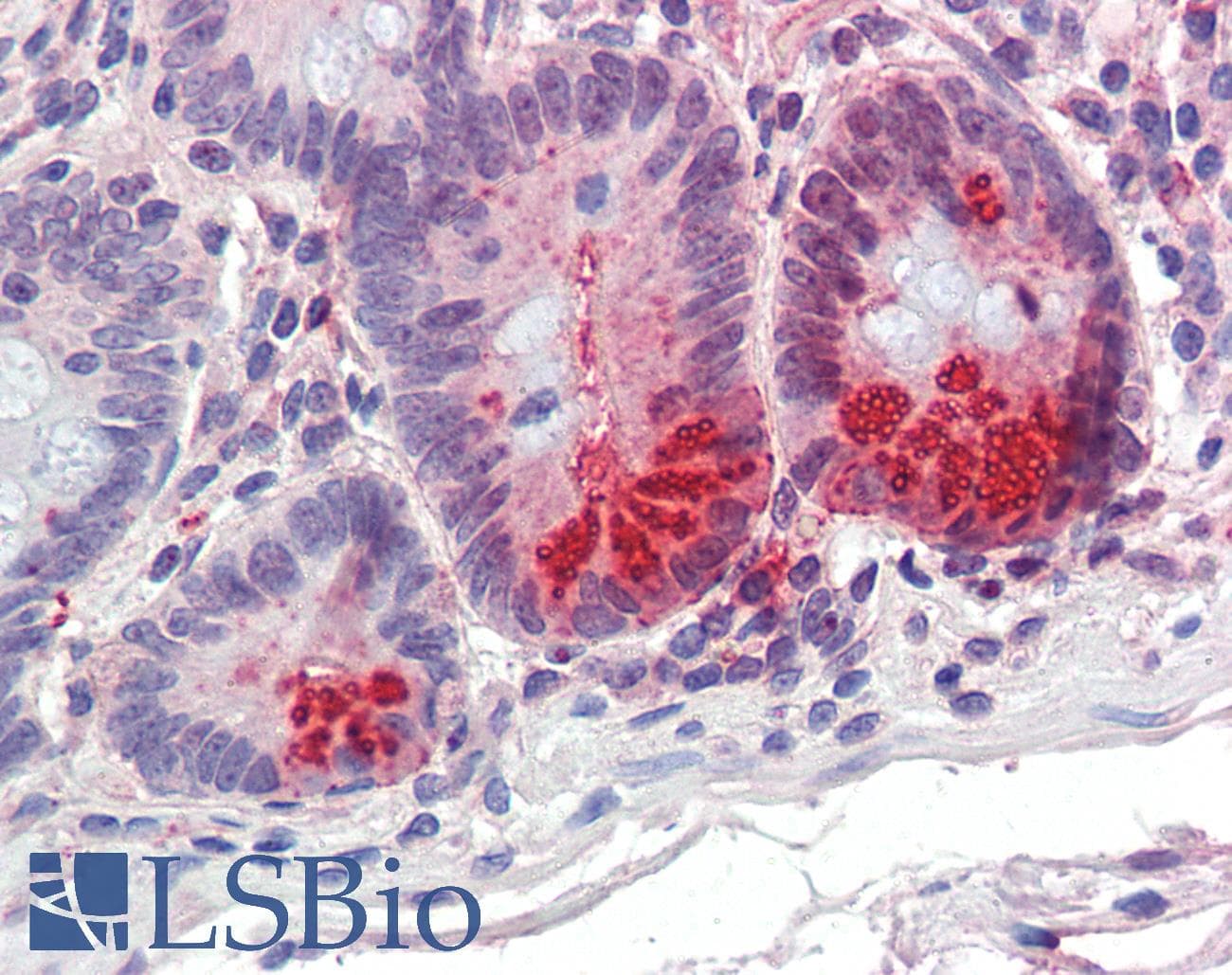 IHC-plus™ 5-Alpha Reductase / SRD5A1 Antibody (aa173-184)