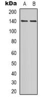 Polyclonal Rabbit anti-Human PER2 Antibody (phospho-Ser662, IHC, WB)
