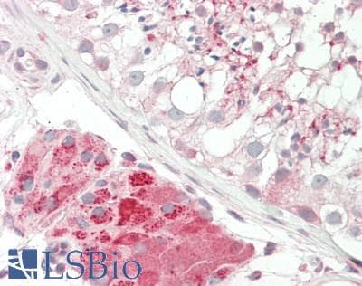 IHC-plus™ Polyclonal Rabbit anti-Human Neurofibromin / NF1 Antibody (aa1526-1575, IHC, WB)