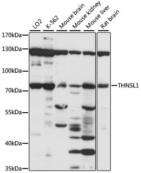 Polyclonal Rabbit anti-Human THNSL1 Antibody (WB)