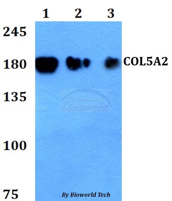 COL5A2 / Collagen V Alpha 2 Antibody