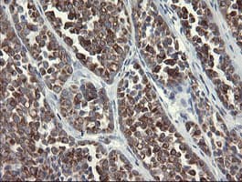 SLA2 / SLAP2 Antibody (clone OTI3A7)