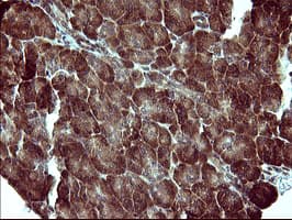 MAP2K1 / MKK1 / MEK1 Antibody (clone OTI5D3)