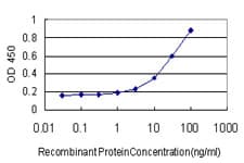 IHC-plus™ MEF2A / MEF2 Antibody (clone 3F6)